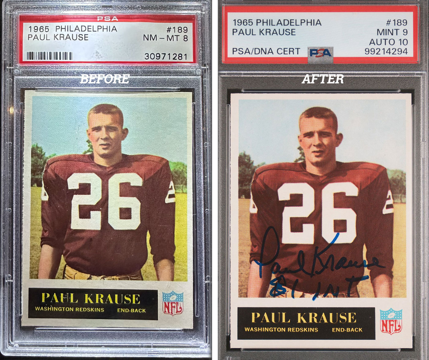 HOF-Before-After-18